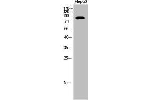 Western Blot analysis of HepG2 cells using Acetyl-PCAF (K428) Polyclonal Antibody