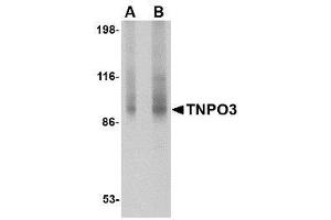Image no. 1 for anti-Transportin 3 (TNPO3) (N-Term) antibody (ABIN1494360) (Transportin 3 anticorps  (N-Term))