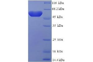 SDS-PAGE (SDS) image for Atonal Homolog 1 (Drosophila) (ATOH1) (AA 1-354), (full length) protein (His-SUMO Tag) (ABIN5711632)