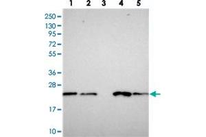 Western blot analysis of Lane 1: RT-4, Lane 2: U-251 MG, Lane 3: Human Plasma, Lane 4: Liver, Lane 5: Tonsil with COMMD2 polyclonal antibody  at 1:250-1:500 dilution.