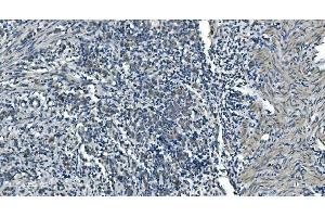 IHC analysis of TIMM8A/DDP using anti-TIMM8A/DDP antibody (ABIN7600039). (TIMM8A/DDP anticorps  (AA 14-97))