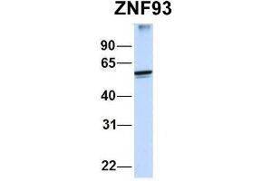 Host:  Rabbit  Target Name:  ZNF93  Sample Type:  Human MCF7  Antibody Dilution:  1. (ZNF93 anticorps  (N-Term))