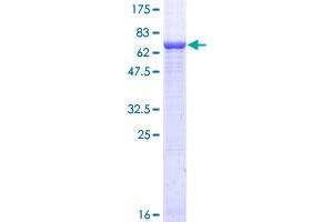 Image no. 1 for GNAS Complex Locus (GNAS) (AA 1-394) protein (GST tag) (ABIN1355349)