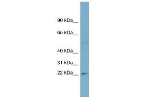 RPL13A antibody used at 1 ug/ml to detect target protein.