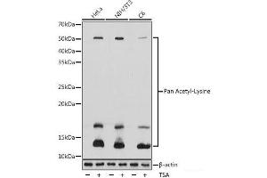 Western blot analysis of extracts of various cell lines using Pan Acetyl-Lysine Polyclonal Antibody at dilution of 1:1000. (Acetylated Lysine anticorps)