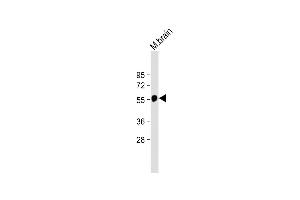 Anti-beta Tubulin Antibody at 1:2000 dilution + Mouse brain lysate Lysates/proteins at 20 μg per lane.