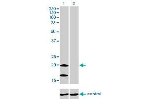 NDUFS4 anticorps  (AA 66-175)