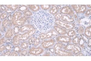 Detection of IDUa in Human Kidney Tissue using Polyclonal Antibody to Iduronidase Alpha L (IDUa) (IDUA anticorps  (AA 28-306))