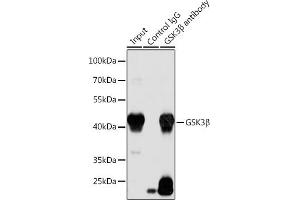 Immunoprecipitation analysis of 200 μg extracts of LO2 cells using 3 μg GSK3β antibody . (GSK3 beta anticorps)
