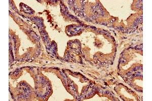 Immunohistochemistry of paraffin-embedded human prostate tissue using ABIN7147903 at dilution of 1:100 (Claudin 3 anticorps  (AA 181-220))