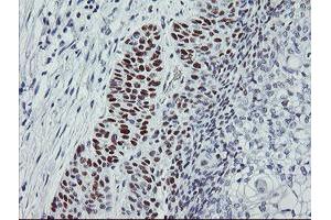 Image no. 1 for anti-Tumor Protein P53 (TP53) antibody (ABIN1499967) (p53 anticorps)
