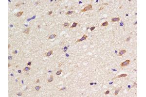 Formalin-fixed and paraffin embedded rat brain labeled with Rabbit Anti-SSTR3 Polyclonal Antibody, Unconjugated  at 1:200 followed by conjugation to the secondary antibody and DAB staining (SSTR3 anticorps)