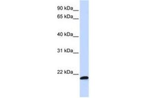 Image no. 1 for anti-Chromosome 21 Open Reading Frame 56 (C21orf56) (AA 108-157) antibody (ABIN6740942)