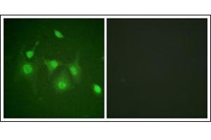 Immunofluorescence analysis of HepG2 cells, using HDAC6 Antibody. (HDAC6 anticorps  (N-Term))