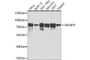 Western blot analysis of extracts of various cell lines using IGF2BP3 Polyclonal Antibody at dilution of 1:1000. (IGF2BP3 anticorps)