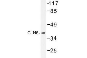 Image no. 1 for anti-Ceroid-Lipofuscinosis, Neuronal 6, Late Infantile, Variant (CLN6) antibody (ABIN317825) (CLN6 anticorps)