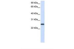 Image no. 1 for anti-Peroxiredoxin 1 (PRDX1) (N-Term) antibody (ABIN6738463) (Peroxiredoxin 1 anticorps  (N-Term))