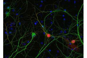 Indirect immunostaining of PFA fixed rat hippocampus neurons with anti-calbindin (dilution 1 : 5000; red) and mouse anti-MAP 2 (, dilution 1 : 1000; green). (CALB1 anticorps)