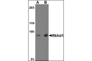 Western blot analysis of Rkhd1 in MDA-MB-361 cell lysate with this product at (A) 1 µg/ml and (B) 2 μg/ml.