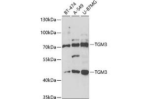 Western blot analysis of extracts of various cell lines, using TGM3 antibody (ABIN6132263, ABIN6149094, ABIN6149095 and ABIN6221560) at 1:1000 dilution. (TGM3 anticorps  (AA 1-180))