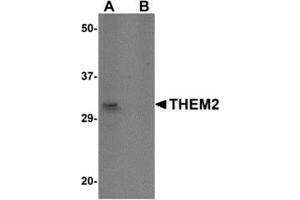 Western blot analysis of THEM2 in HepG2 cell lysate with this product at 1 μg/ml in (A) the absence and (B) the presence of blocking peptide. (THEM2 anticorps  (C-Term))