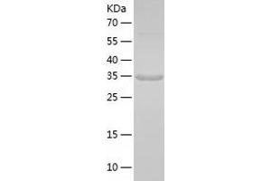 Western Blotting (WB) image for Amnionless (AMN) (AA 20-357) protein (His tag) (ABIN7288654) (AMN Protein (AA 20-357) (His tag))