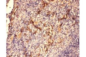 IHC-P: C5a antibody testing of mouse spleen tissue (C5A anticorps  (N-Term))