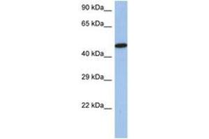 Image no. 1 for anti-Interferon Regulatory Factor 5 (IRF5) (AA 395-444) antibody (ABIN6742243) (IRF5 anticorps  (AA 395-444))