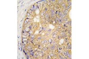 Image no. 3 for anti-Gap Junction Protein, beta 6, 30kDa (GJB6) (AA 95-124), (N-Term) antibody (ABIN357095)