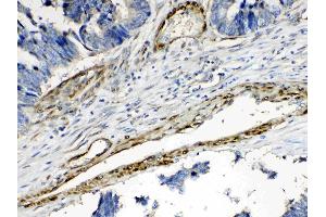 IHC analysis of CPI17 alpha using anti- CPI17 alpha antibody .