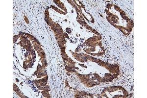 IHC analysis of RNF169 using anti-RNF169 antibody (ABIN6719530).