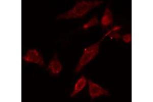 ABIN6274758 staining COLO cells by IF/ICC. (RPS5 anticorps  (Internal Region))