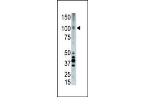 Western Blotting (WB) image for anti-Low Density Lipoprotein Receptor-Related Protein 8, Apolipoprotein E Receptor (LRP8) (C-Term) antibody (ABIN358640) (LRP8 anticorps  (C-Term))
