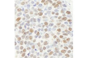 Immunohistochemistry (IHC) image for anti-Mismatch Repair Protein 2 (MSH2) (C-Term) antibody (ABIN7448673) (MSH2 anticorps  (C-Term))