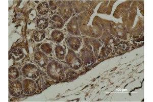 Immunohistochemistry (IHC) analysis of paraffin-embedded Mouse Cecal Tissue using alpha-SMA Monoclonal Antibody. (alpha-SMA anticorps)