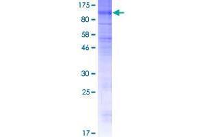 Image no. 1 for Organic Anion Transporter H (OATP-H) (AA 1-724) protein (GST tag) (ABIN1320557)