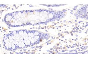 Detection of IDO in Human Colon Tissue using Polyclonal Antibody to Indoleamine-2,3-Dioxygenase (IDO)