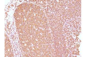 Formalin-fixed, paraffin-embedded human Tonsil stained with CD45RB Mouse Monoclonal Antibody (PD7/26). (CD45 anticorps)