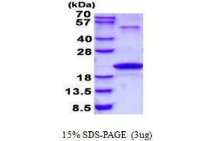 Figure annotation denotes ug of protein loaded and % gel used. (Neurotensin Protein (NTS))
