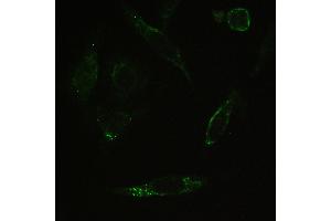 IHC analysis of PPP1R12A using anti-PPP1R12A antibody . (PPP1R12A anticorps  (N-Term))