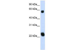 WB Suggested Anti-KLHL26 Antibody Titration:  0. (KLHL26 anticorps  (Middle Region))