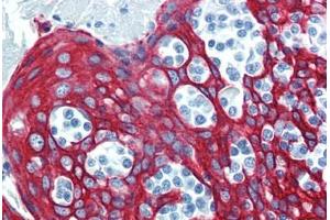Tonsil, Human: Formalin-Fixed, Paraffin-Embedded (FFPE) (KRT14 anticorps  (C-Term))