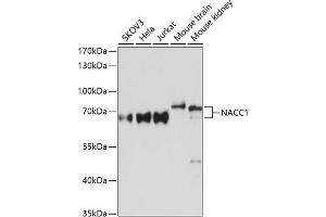 Western blot analysis of extracts of various cell lines, using N Antibody (ABIN6132231, ABIN6144337, ABIN6144339 and ABIN6215418) at 1:3000 dilution. (NAC1 anticorps  (AA 170-340))