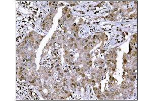 IHC analysis of KMT1B/SUV39H2 using anti-KMT1B/SUV39H2 antibody (ABIN7602135). (SUV39H2 anticorps  (AA 6-410))