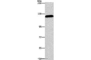 Western blot analysis of Hela cell, using AGAP2 Polyclonal Antibody at dilution of 1:700 (AGAP2 anticorps)