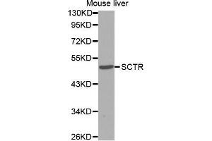 Western Blotting (WB) image for anti-Secretin Receptor (SCTR) antibody (ABIN3017416) (SCTR anticorps)