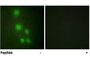 Immunofluorescence analysis of HUVEC cells, using ACTL6A polyclonal antibody .