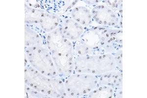 Immunohistochemistry of paraffin-embedded mouse kidney using SMEK1 Rabbit pAb (ABIN6130699, ABIN6148130, ABIN6148131 and ABIN6224584) at dilution of 1:100 (40x lens). (SMEK1 anticorps  (AA 395-594))