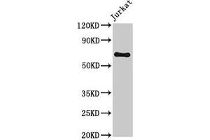 Western Blot Positive WB detected in: Jurkat whole cell lysate All lanes: GNL1 antibody at 3. (GNL1 anticorps  (AA 251-500))