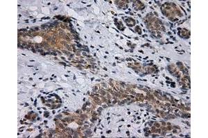 Immunohistochemical staining of paraffin-embedded breast tissue using anti-SIL1 mouse monoclonal antibody. (SIL1 anticorps)